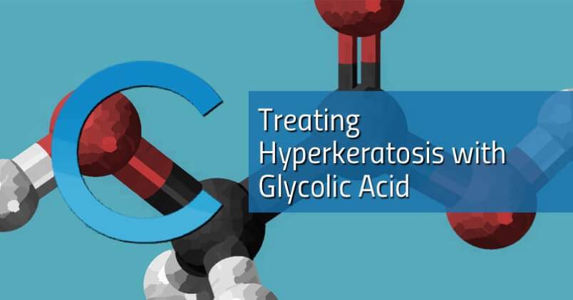 Hyperkeratosis Glycolic Acid